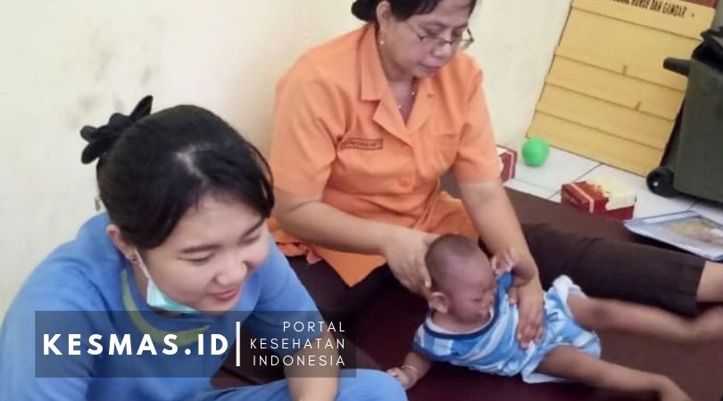 Penanganan balita gizi buruk oleh fisioterapis