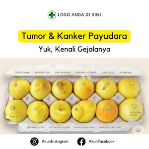 Kenali Gejala Tumor dan Kanker Payudara
