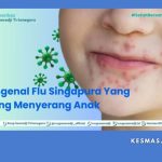 HFMD / Flu Singapura