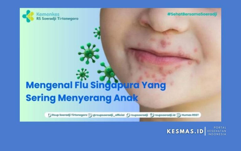 HFMD / Flu Singapura