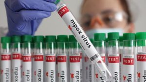 Siaga Mpox: Definisi, Penularan, Gejala, dan Penanganan