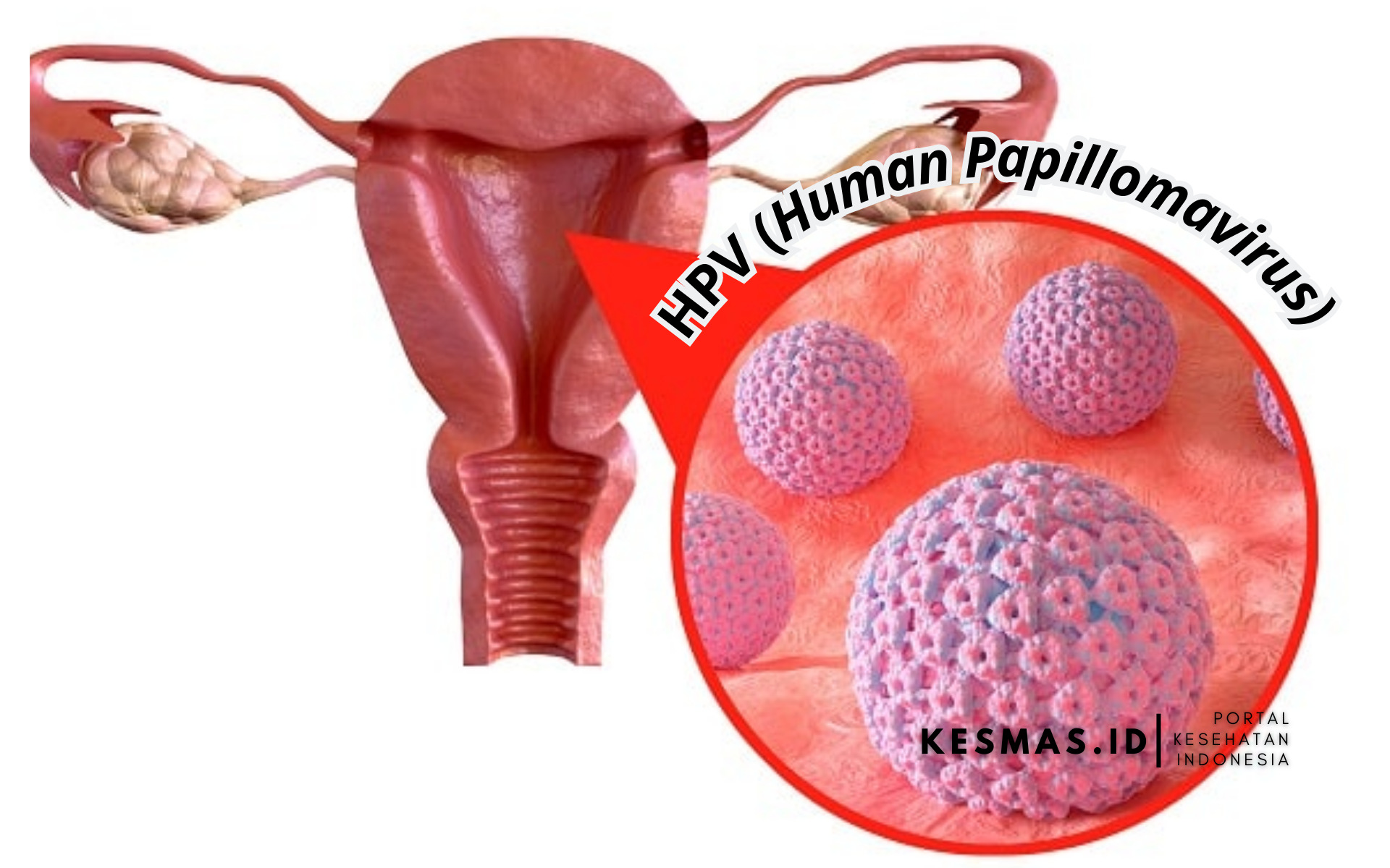 Siapa Saja yang Membutuhkan Vaksin HPV