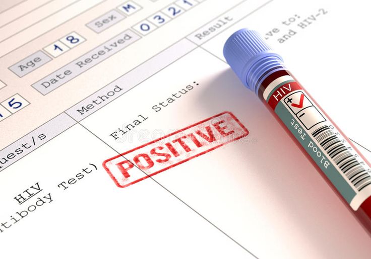 Tingkatkan Kualitas Hidup, Bebaskan ODHA dari Stigma Sosial