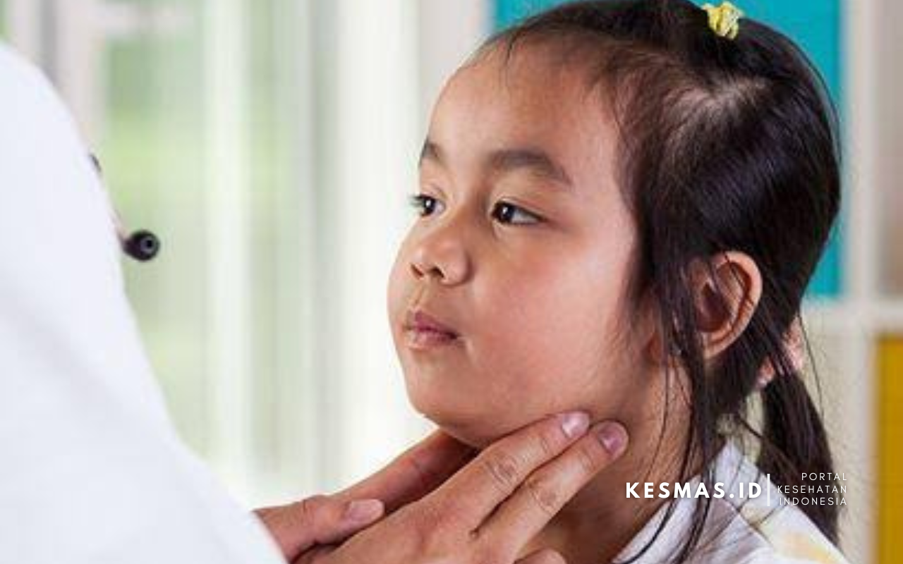 Parotitis: Penyakit Kelenjar Air Liur yang Perlu Dikenali