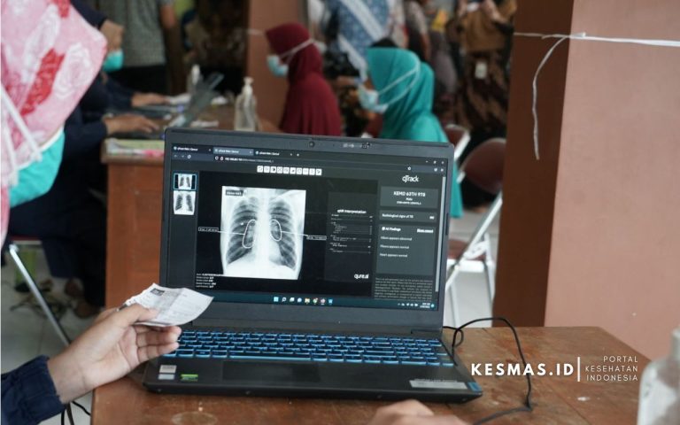 Skrining Tuberkulosis