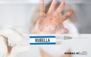 Kenali-Rubella-Campak-Jerman-Penularan-Pencegahan-dan-Pengobatannya.jpg