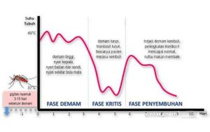 siklus demam pada penyakit DBD yang dikenal sebagai fase "pelana kuda"