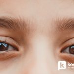 Anak Tak Mengeluh Mata Kabur, Perlukah Cek Mata?